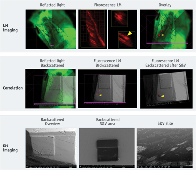 CELL BIOLOGY/CORRELATIVE MICROSCOPY: A Powerful Pairing For Cell ...