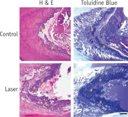 1407bowbreakf2 1407bowbreakf2