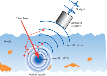 FIGURE 1. PA signal generation and detection.