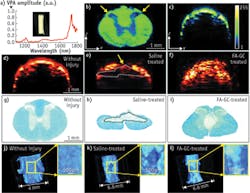 FIGURE 6. VPA spectra and comparison of spinal cord tissue with/without contusive injury harvested 28 days post-injury: VPA spectra of white matter of spinal cord (a); VPA image of cross-sectioned normal spinal cord (b); B-scan of whole spinal cord without injury (c); B-scan VPA image of normal spinal cord tissue and of contusive injured tissue with or without treatment (d-f); Luxol fast blue staining of myelin in normal spinal cord and in contusive injured spinal cord with or without treatment (g-i); and 3D PA image showing the white matter loss in normal spinal cord and in injured spinal cord with and without treatment (j-l). The inset shows the enlarged image of the spinal cord; dashed lines indicate white-matter loss. FIGURE 6. VPA spectra and comparison of spinal cord tissue with/without contusive injury harvested 28 days post-injury: VPA spectra of white matter of spinal cord (a); VPA image of cross-sectioned normal spinal cord (b); B-scan of whole spinal cord without injury (c); B-scan VPA image of normal spinal cord tissue and of contusive injured tissue with or without treatment (d-f); Luxol fast blue staining of myelin in normal spinal cord and in contusive injured spinal cord with or without treatment (g-i); and 3D PA image showing the white matter loss in normal spinal cord and in injured spinal cord with and without treatment (j-l). The inset shows the enlarged image of the spinal cord; dashed lines indicate white-matter loss.