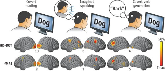 FIGURE 3. DOT maps of language processing validated against fMRI.