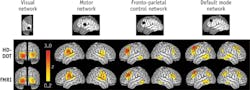 FIGURE 4. As part of an effort to validate data quality of HD-DOT against fMRI, we generated maps of 'resting-state' activity in the relatively simple visual and motor processing networks (left) and the more complex networks that perform cognitive functions such as control over processing and self-reflection (right). FIGURE 4. As part of an effort to validate data quality of HD-DOT against fMRI, we generated maps of 'resting-state' activity in the relatively simple visual and motor processing networks (left) and the more complex networks that perform cognitive functions such as control over processing and self-reflection (right).