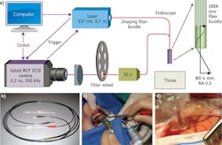 FIGURE 5. The imaging bundle probe is depicted as part of (a) the overall FLIM system and (b) in a separate photograph. The probe's distal end includes an optically transparent spacer. The imaging probe has been applied to (c) the oral cavity, and (d) the brain cortex in human subjects. FIGURE 5. The imaging bundle probe is depicted as part of (a) the overall FLIM system and (b) in a separate photograph. The probe's distal end includes an optically transparent spacer. The imaging probe has been applied to (c) the oral cavity, and (d) the brain cortex in human subjects.