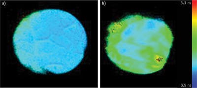 FIGURE 6. A normal cortex (a) is distinct from tumor tissue (b) in fluorescence lifetime imaging of human patients. Results are for the 460 nm emission band (NADH fluorescence).