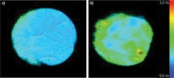 FIGURE 6. A normal cortex (a) is distinct from tumor tissue (b) in fluorescence lifetime imaging of human patients. Results are for the 460 nm emission band (NADH fluorescence). FIGURE 6. A normal cortex (a) is distinct from tumor tissue (b) in fluorescence lifetime imaging of human patients. Results are for the 460 nm emission band (NADH fluorescence).