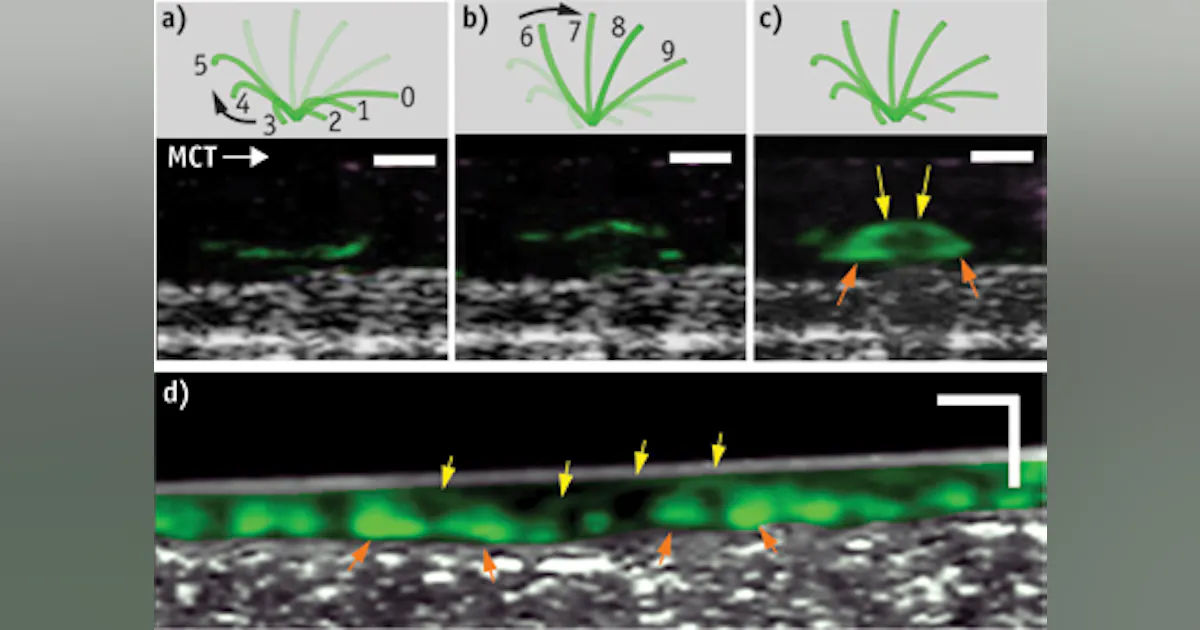 Oct Microcomb OPTICAL COHERENCE TOMOGRAPHY: High-resolution micro-OCT uncovers ...