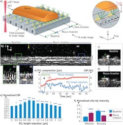 1409bowchuf5 1409bowchuf5