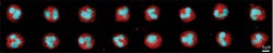 FIGURE 4. Images of height maps of neutrophil cells collected by the optical Coulter counter are shown in red. The nuclear morphology is also simultaneously observed using a nucleic acid fluorescence stain, Syto16, shown in blue.
