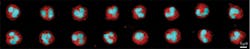 FIGURE 4. Images of height maps of neutrophil cells collected by the optical Coulter counter are shown in red. The nuclear morphology is also simultaneously observed using a nucleic acid fluorescence stain, Syto16, shown in blue. FIGURE 4. Images of height maps of neutrophil cells collected by the optical Coulter counter are shown in red. The nuclear morphology is also simultaneously observed using a nucleic acid fluorescence stain, Syto16, shown in blue.