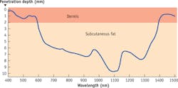 FIGURE 2. Depth of light penetration into tissue depends on wavelength and is limited by scattering and absorption. FIGURE 2. Depth of light penetration into tissue depends on wavelength and is limited by scattering and absorption.