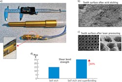 FIGURE 4. A compact multi-wavelength dental handpiece is designed for both soft tissue treatments and hard, including etching of dental surfaces (a). Acid etching of dental surfaces is prone to failure of dental restoration (b), while laser etching (c) produces more reliable outcomes (d). FIGURE 4. A compact multi-wavelength dental handpiece is designed for both soft tissue treatments and hard, including etching of dental surfaces (a). Acid etching of dental surfaces is prone to failure of dental restoration (b), while laser etching (c) produces more reliable outcomes (d).