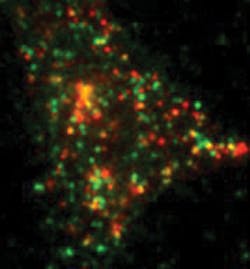 FIGURE 4. This total internal reflection fluorescence (TIRF) micrograph shows single GFP-labeled syntaxin molecules (green) and insulin-containing granules (red) in a pancreatic beta-cell. FIGURE 4. This total internal reflection fluorescence (TIRF) micrograph shows single GFP-labeled syntaxin molecules (green) and insulin-containing granules (red) in a pancreatic beta-cell.