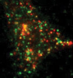 FIGURE 4. This total internal reflection fluorescence (TIRF) micrograph shows single GFP-labeled syntaxin molecules (green) and insulin-containing granules (red) in a pancreatic beta-cell. FIGURE 4. This total internal reflection fluorescence (TIRF) micrograph shows single GFP-labeled syntaxin molecules (green) and insulin-containing granules (red) in a pancreatic beta-cell.
