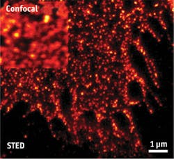 FIGURE 3. Stimulated emission depletion, or STED, super-resolution microscopy provides far higher resolution than confocal microscopy to image single cells.