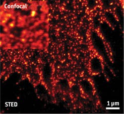 FIGURE 3. Stimulated emission depletion, or STED, super-resolution microscopy provides far higher resolution than confocal microscopy to image single cells. FIGURE 3. Stimulated emission depletion, or STED, super-resolution microscopy provides far higher resolution than confocal microscopy to image single cells.