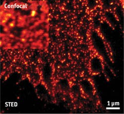 FIGURE 3. Stimulated emission depletion, or STED, super-resolution microscopy provides far higher resolution than confocal microscopy to image single cells. FIGURE 3. Stimulated emission depletion, or STED, super-resolution microscopy provides far higher resolution than confocal microscopy to image single cells.