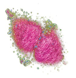 1503bow Pollaro 02 Cancer Cell 1503bow Pollaro 02 Cancer Cell