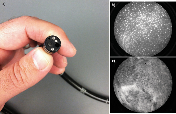 FIGURE 1. This fiber-optic microscope (a) can be inserted into a patient's esophagus to distinguish healthy (b) from cancerous tissue (c).