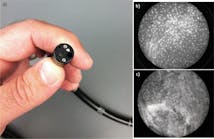 FIGURE 1. This fiber-optic microscope (a) can be inserted into a patient&apos;s esophagus to distinguish healthy (b) from cancerous tissue (c).