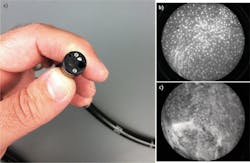 FIGURE 1. This fiber-optic microscope (a) can be inserted into a patient's esophagus to distinguish healthy (b) from cancerous tissue (c). FIGURE 1. This fiber-optic microscope (a) can be inserted into a patient's esophagus to distinguish healthy (b) from cancerous tissue (c).