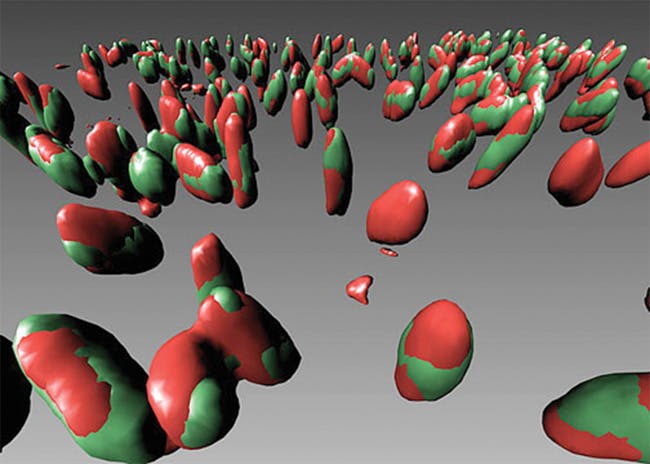 Purdue University researchers have demonstrated the ability to detect E. coli in one hour using infrared spectroscopy. This image of E. coli cells, captured by Colin Rickman of the Centre for Integrative Physiology at the University of Edinburgh (Scotland), was named an Image of Distinction in Nikon's Small World 2008 competition.