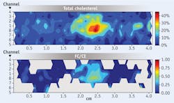 FIGURE 4. Chemical concentrations within a human coronary artery are contour-mapped to show the total cholesterol concentrations throughout the artery segment (above), and the non-esterified cholesterol to cholesterol ester (FC/CE) ratio, calculated when the amount of total cholesterol was >5% (below). The plot abscissa indicates the length along the sample, while the ordinate indicates which fiber sensor in the catheter is recording information along a given row. The large increase in the FC content within the focal deposit centered ~2.5 cm suggests the presence of a necrotic core containing crystalline cholesterol. Color coding is used to accentuate the contour plots of the component concentrations in a given map. FIGURE 4. Chemical concentrations within a human coronary artery are contour-mapped to show the total cholesterol concentrations throughout the artery segment (above), and the non-esterified cholesterol to cholesterol ester (FC/CE) ratio, calculated when the amount of total cholesterol was >5% (below). The plot abscissa indicates the length along the sample, while the ordinate indicates which fiber sensor in the catheter is recording information along a given row. The large increase in the FC content within the focal deposit centered ~2.5 cm suggests the presence of a necrotic core containing crystalline cholesterol. Color coding is used to accentuate the contour plots of the component concentrations in a given map.