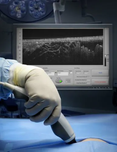Hand Held Oct Handheld OCT probe enables label-free imaging for cancer removal ...