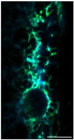 Aging 2 Web Aging 2 Web