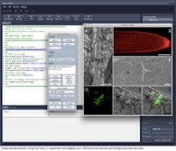 Content Dam Bow En Articles 2014 02 Automated Microscope By Carl Zeiss Microscopy Leftcolumn Article Thumbnailimage Axio Scan Z1 Automated Microscope From Carl Zeiss Microscopy Content Dam Bow En Articles 2014 02 Automated Microscope By Carl Zeiss Microscopy Leftcolumn Article Thumbnailimage Axio Scan Z1 Automated Microscope From Carl Zeiss Microscopy
