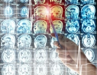 Content Dam Bow En Articles 2014 05 Nir Spectroscopy Tool Interrogates And Shows How The Brain Relearns Leftcolumn Article Thumbnailimage Functional Near Infrared Spectroscopy Fnirs Instrument Capable Of Identifying Stroke Affected Areas Of The Brain