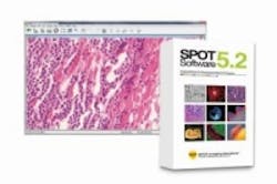 Content Dam Bow En Articles 2014 12 Software For Bioimaging Cameras By Spot Imaging Solutions Leftcolumn Article Thumbnailimage File Content Dam Bow En Articles 2014 12 Software For Bioimaging Cameras By Spot Imaging Solutions Leftcolumn Article Thumbnailimage File