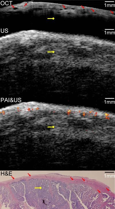 Content Dam Bow Online Articles 2011 09 Ovarian Cancer