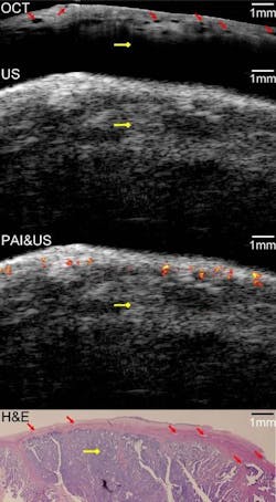Content Dam Bow Online Articles 2011 09 Ovarian Cancer Content Dam Bow Online Articles 2011 09 Ovarian Cancer