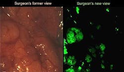 Content Dam Bow Online Articles 2011 09 Purdue Fluorescence Surg Content Dam Bow Online Articles 2011 09 Purdue Fluorescence Surg