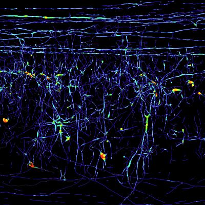 Content Dam Bow Online Articles 2011 12 Spine Max Planck 122811