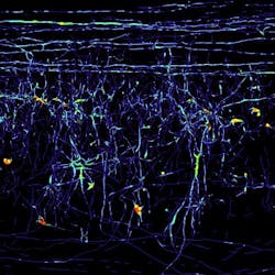 Content Dam Bow Online Articles 2011 12 Spine Max Planck 122811 Content Dam Bow Online Articles 2011 12 Spine Max Planck 122811