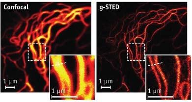 Leica Microsystems will provide next-generation g-STED (gated stimulated emission depletion), licensed from the Max Planck Society and the German Cancer Research Center, in a commercial system that promises to improve resolution and contrast for continuous-wave STED while reducing laser intensity.