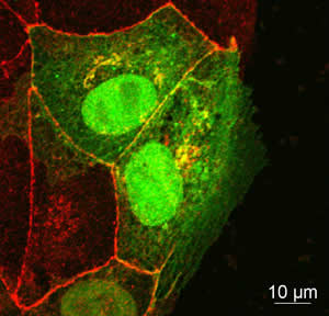 Content Dam Bow Online Articles 2012 02 120217 Occludin Fluorescent Protein