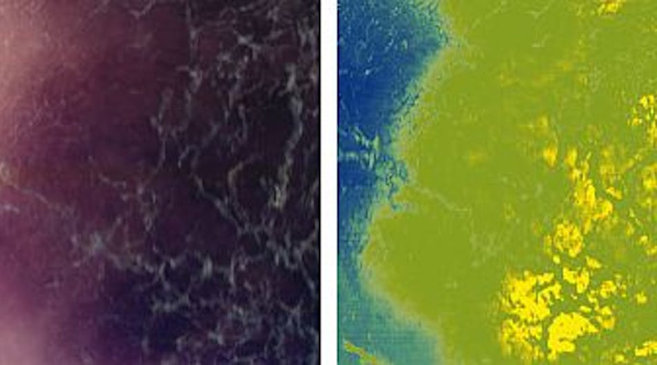 Comparative RGB (left) and hyperspectral (right) images of a melanoma.