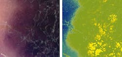 Comparative RGB (left) and hyperspectral (right) images of a melanoma. Comparative RGB (left) and hyperspectral (right) images of a melanoma.