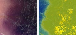 Comparative RGB (left) and hyperspectral (right) images of a melanoma.