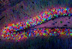Content Dam Bow Online Articles 2012 03 Mit Optogenetics Content Dam Bow Online Articles 2012 03 Mit Optogenetics