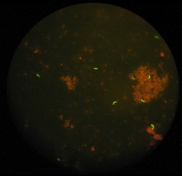 Content Dam Bow Online Articles 2012 08 20120810 153903 Bacilli Klein