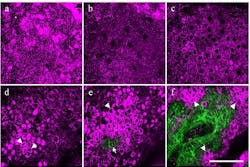 Content Dam Bow Online Articles 2012 12 Skin Aging F1 Web Content Dam Bow Online Articles 2012 12 Skin Aging F1 Web
