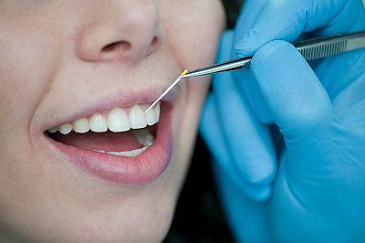 Content Dam Bow Online Articles 2013 01 Fk01 13 G Thema1 Parodontitis Izi Web