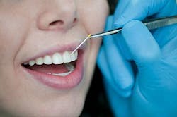 Content Dam Bow Online Articles 2013 01 Fk01 13 G Thema1 Parodontitis Izi Web Content Dam Bow Online Articles 2013 01 Fk01 13 G Thema1 Parodontitis Izi Web