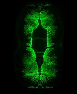 Content Dam Bow Online Articles 2013 06 Glass Eel Picture 3 Web Content Dam Bow Online Articles 2013 06 Glass Eel Picture 3 Web