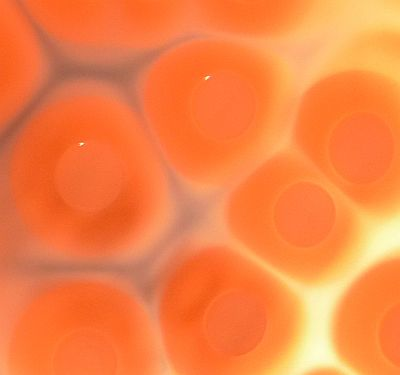 Content Dam Bow Online Articles 2013 07 Staphylococcus Aureus Kolonien C Tom Grunert Web