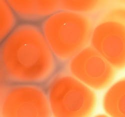 Content Dam Bow Online Articles 2013 07 Staphylococcus Aureus Kolonien C Tom Grunert Web Content Dam Bow Online Articles 2013 07 Staphylococcus Aureus Kolonien C Tom Grunert Web