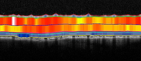 Content Dam Bow Online Articles 2013 12 Scan Of Rat Retina Color Coded Web